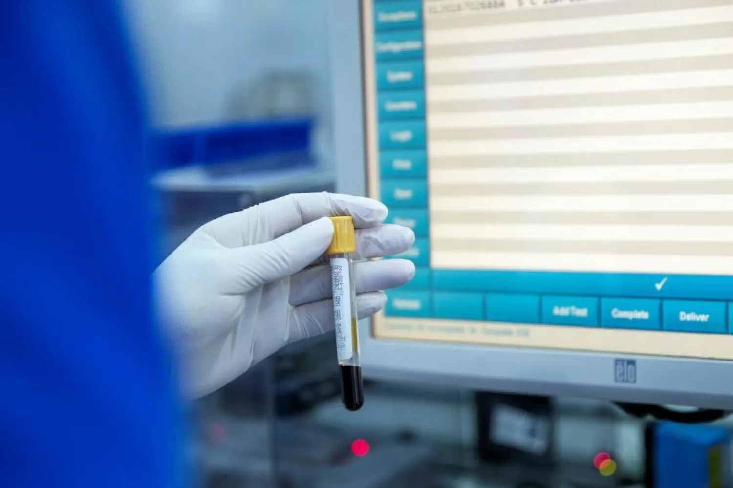 أعلنت روسيا أنه سيتم تصدير اللقاح إلى عدد من الدول من بينها السعودية (الشرق الأوسط)