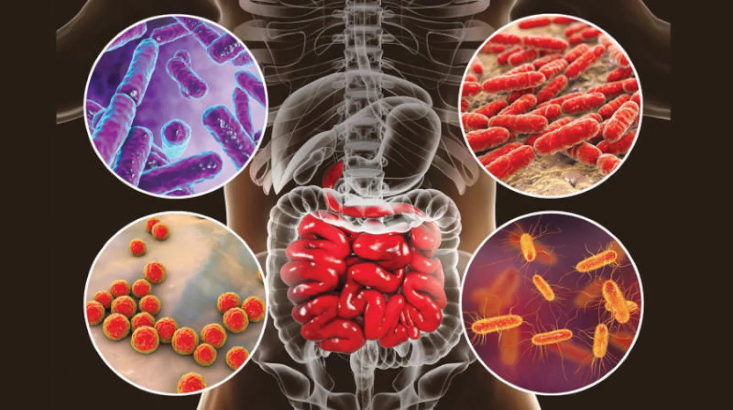 تطوير صيغة رياضية تفرق بين الميكروبيوم الصحي وغير الصحي (مستشفى مايو كلينك)