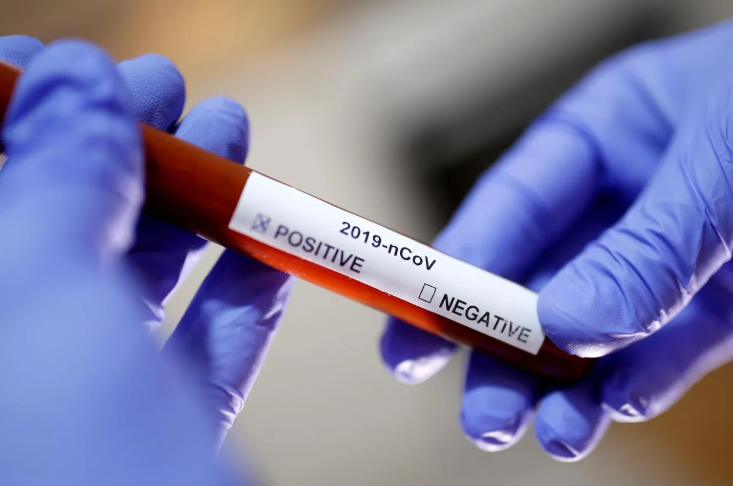 FILE PHOTO: Test tube with the coronavirus name label is seen in this illustration taken on January 29, 2020. REUTERS/Dado Ruvic