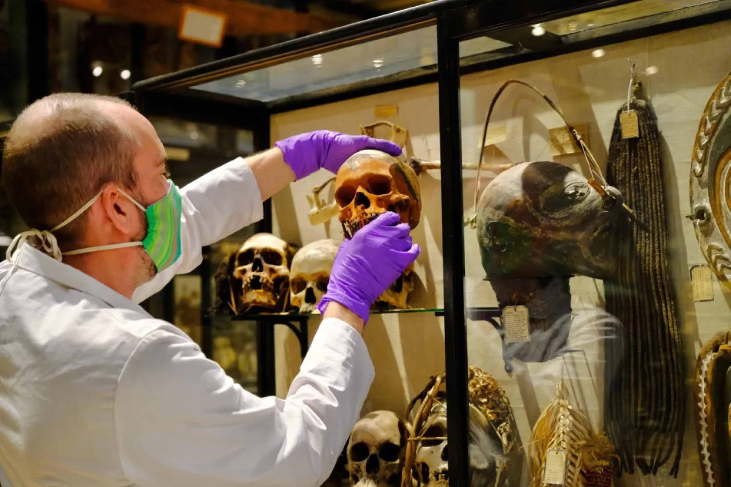 In this image taken in July 2020 and made available by Pitt Rivers Museum, a skull is removed from the Treatment of Dead Enemies case at the Pitt Rivers Museum, part of the University of Oxford, England. AP photo