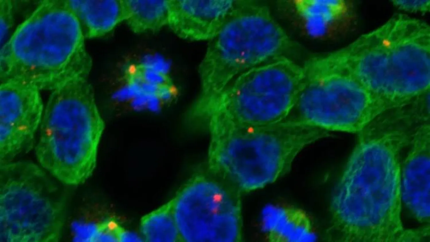 An image taken with a confocal microscope of a field of
non-dividing and dividing human cancer cells is seen at The Institute
of Cancer Research in London. (Image: Reuters)