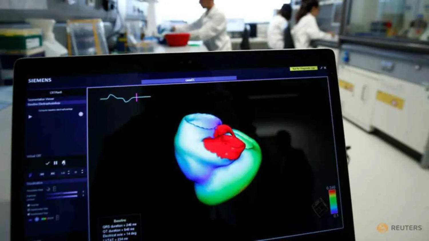 A monitor showing a 3-dimensional scan of a human heart at Heidelberg University Hospital's research wing | Photo: Reuters