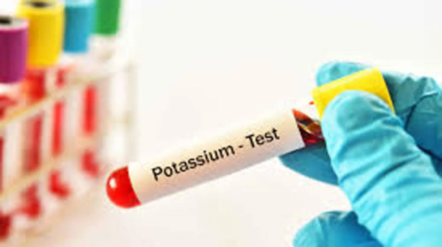 شركة «فيفور فارما» تنظم ندوة بعنوان «فرط بوتاسيوم الدم»... القاتل الصامت