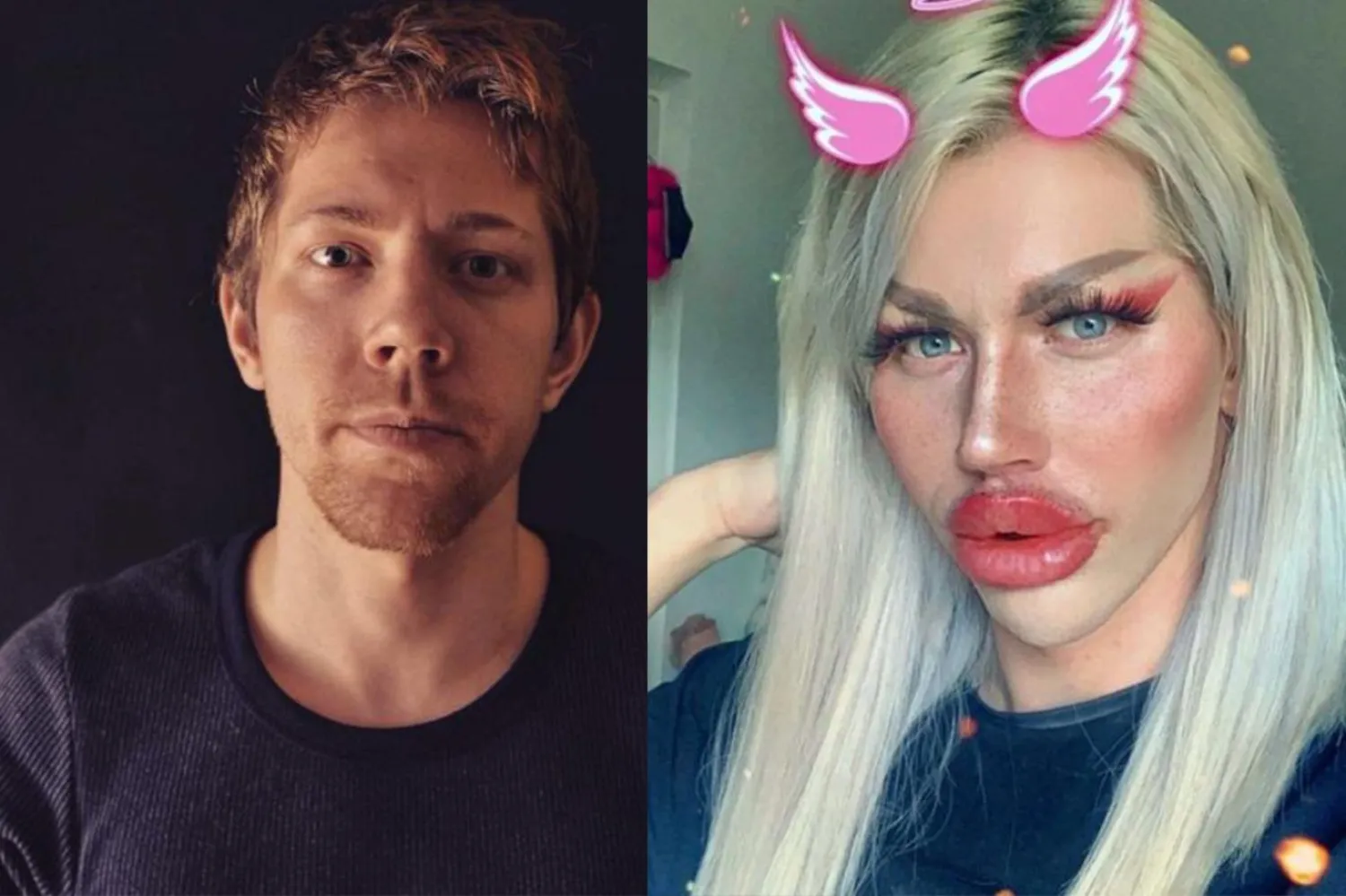 Genç adam, "Kadınlardan hoşlanıyorum ama bazı kızların görünüşümle sorunu var" diyor (slovakwoman) 