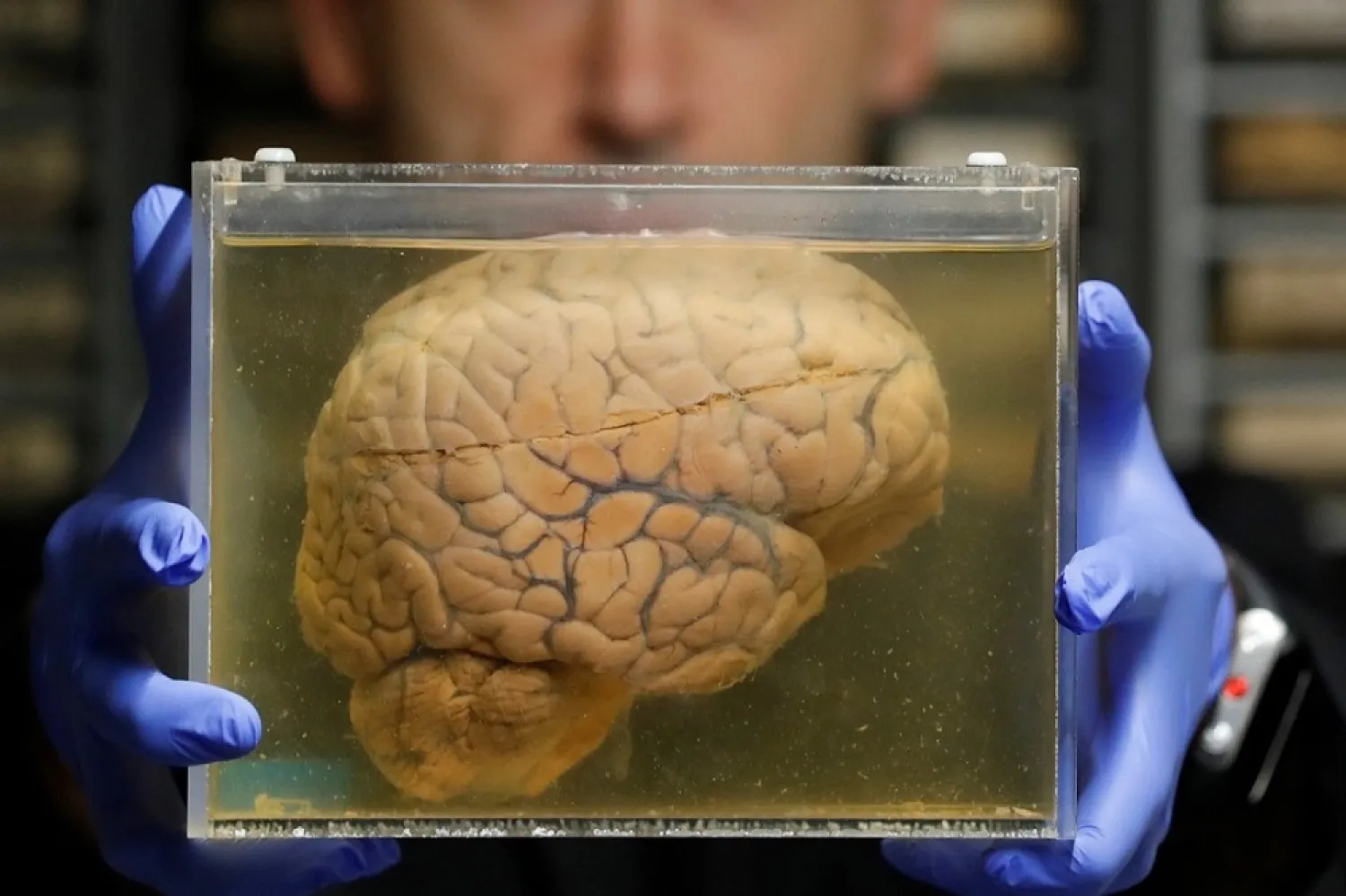 Belgian researcher Manuel Morrens holds a container with a human brain, part of a collection of more than 3,000 brains at the psychiatric hospital in Duffel, Belgium. (Reuters)