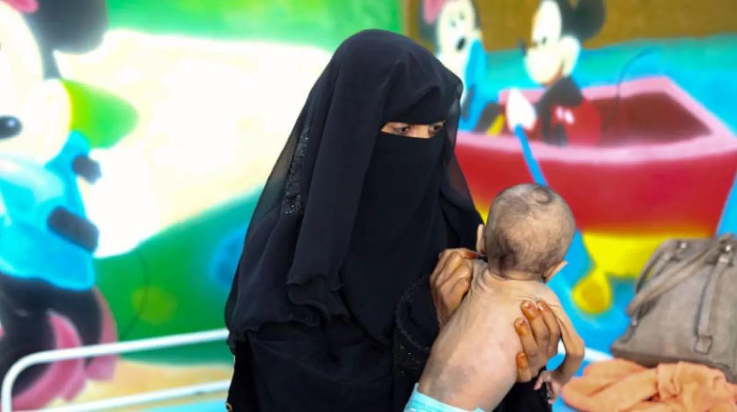 A Yemeni mother holds her baby who suffers from malnutrition. (AFP)