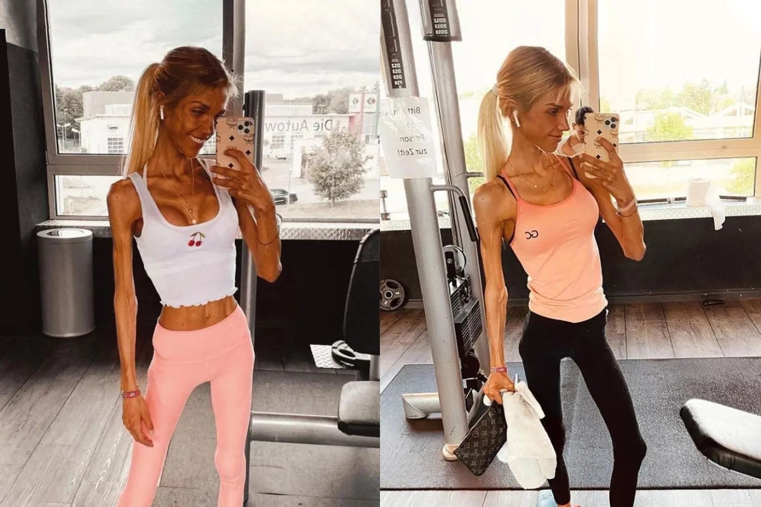 Dünyada 70 milyon insanın yeme bozukluğundan muzdarip olduğu tahmin ediliyor (Instagram / josimariaxx)