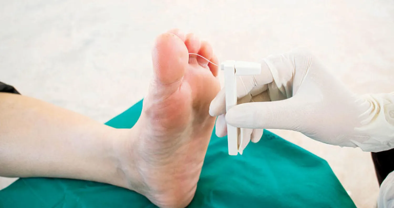 قرح القدم السكرية... وآخر تقنيات علاجها