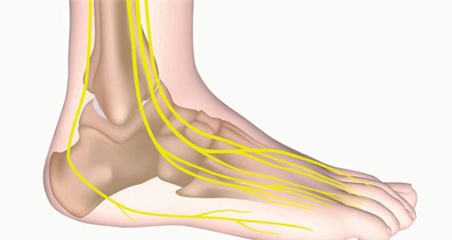 الوقاية من مشاكل القدم السكرية