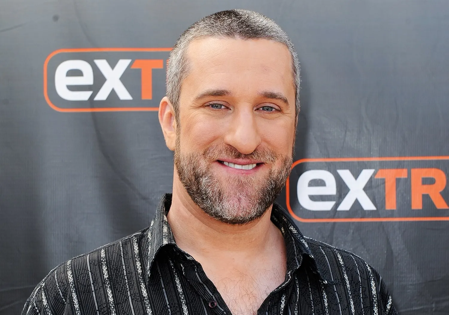 Dustin Diamond. (Getty Images)