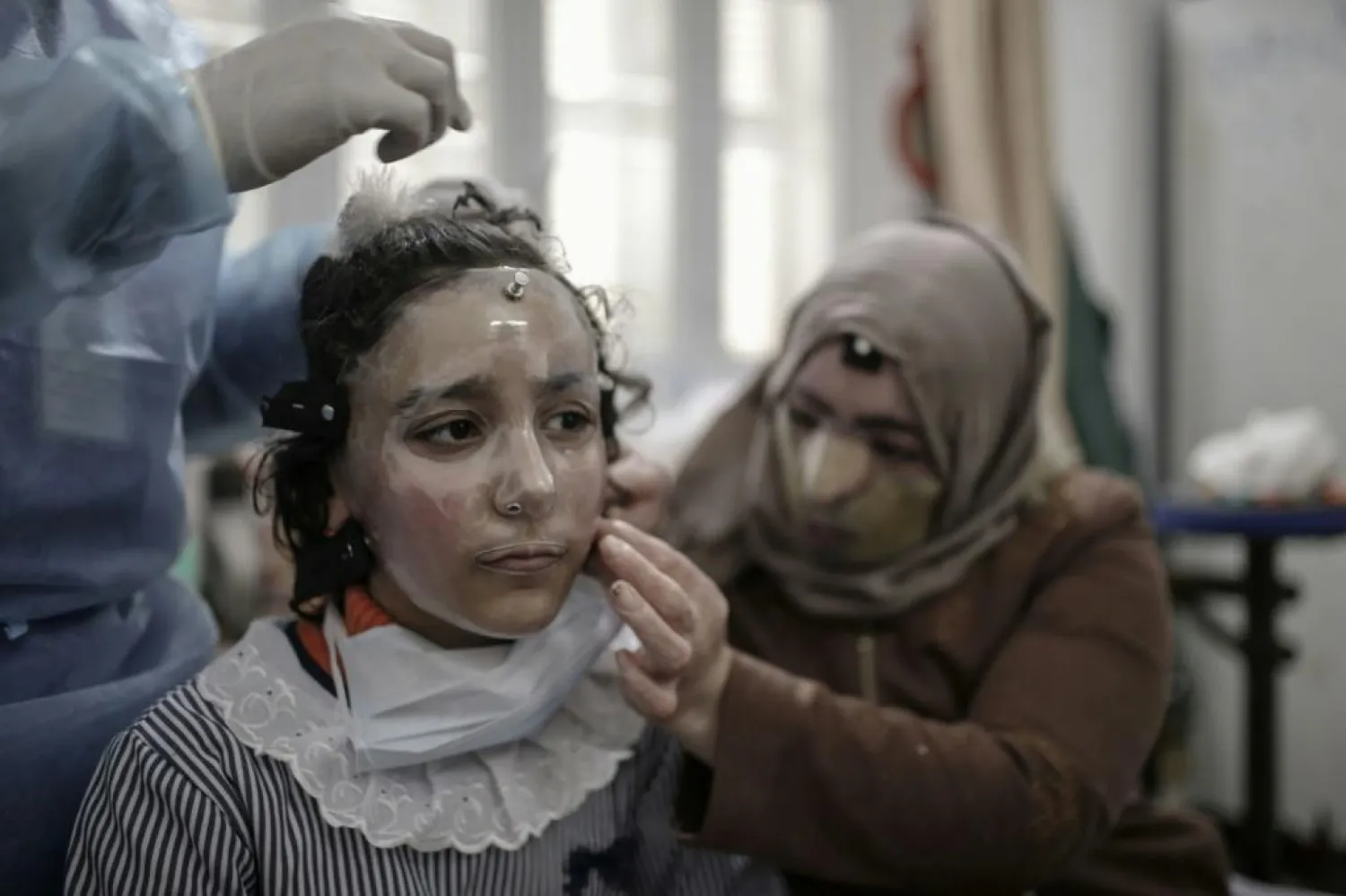 Palestinian schoolgirl Maram al-Amawi has been fitted with a 3D-printed transparent face mask to help heal her severe facial burns -  AFP