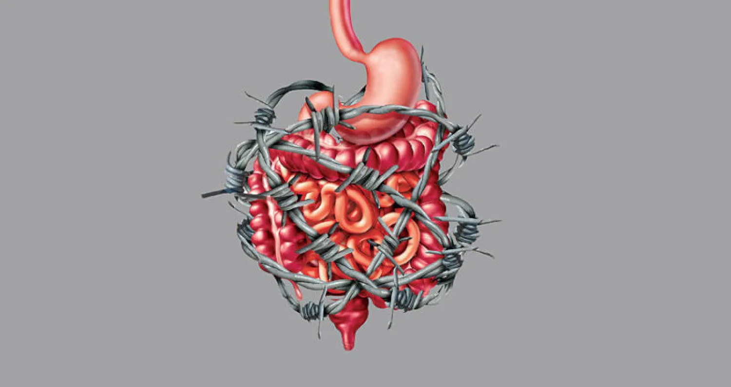 التهاب الأمعاء ومتلازمة القولون العصبي