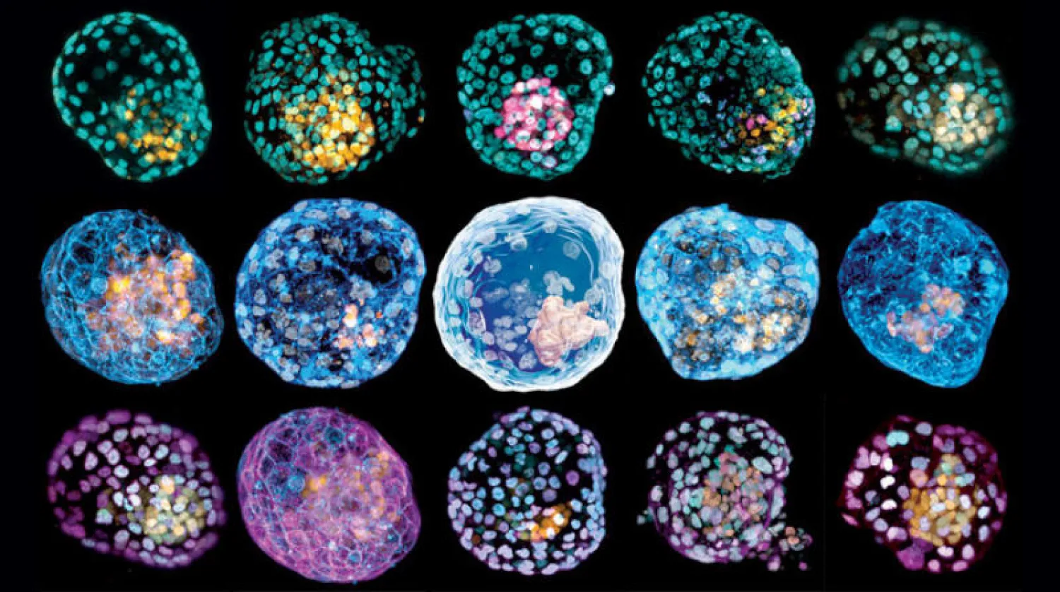 «الكيسة الأريمية» تم إنتاجها باستخدام خلايا الجلد (جامعة موناش)