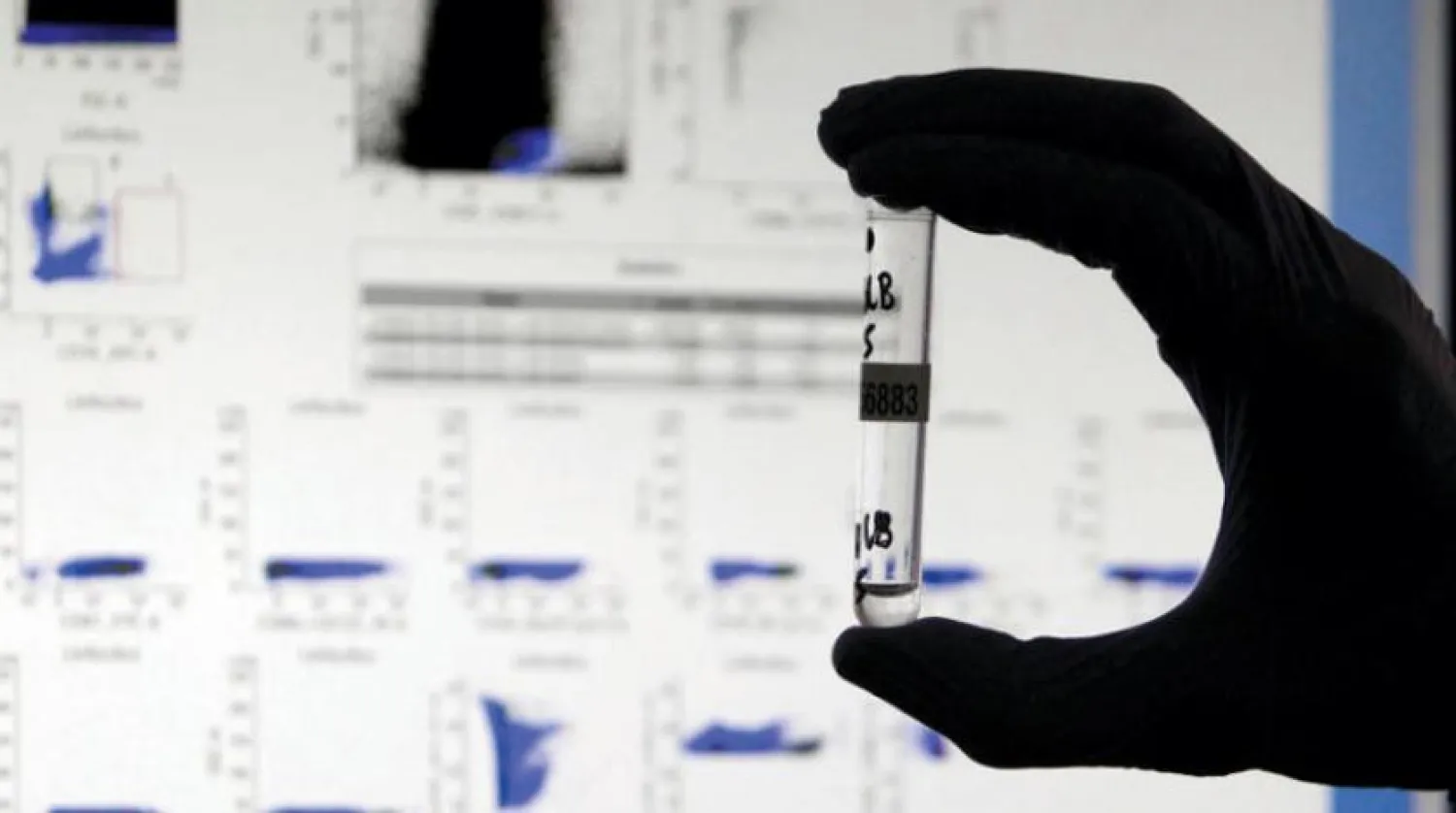 İspanya’daki Alicante Üniversitesi koronavirüs antikorlarına yönelik deneyler gerçekleştiriyor (EPA)