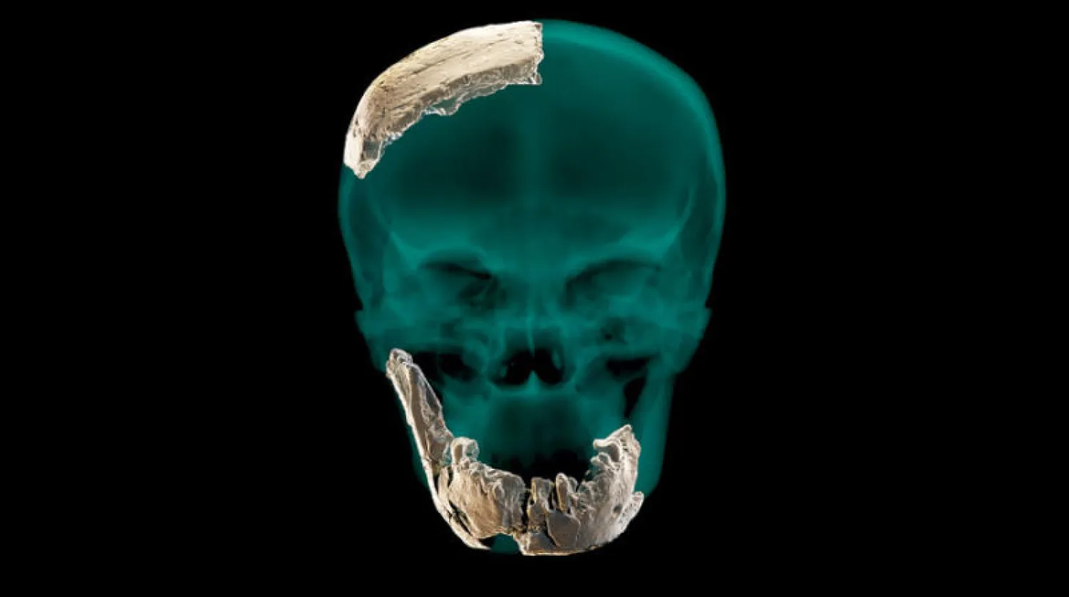 صورة لجمجمة ثابتة وفك سفلي (أ.ف.ب)