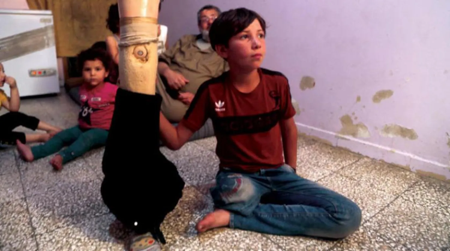 A displaced child who has lost his leg in an explosion in Bab al-Hawa, northern Syria (AFP) 

