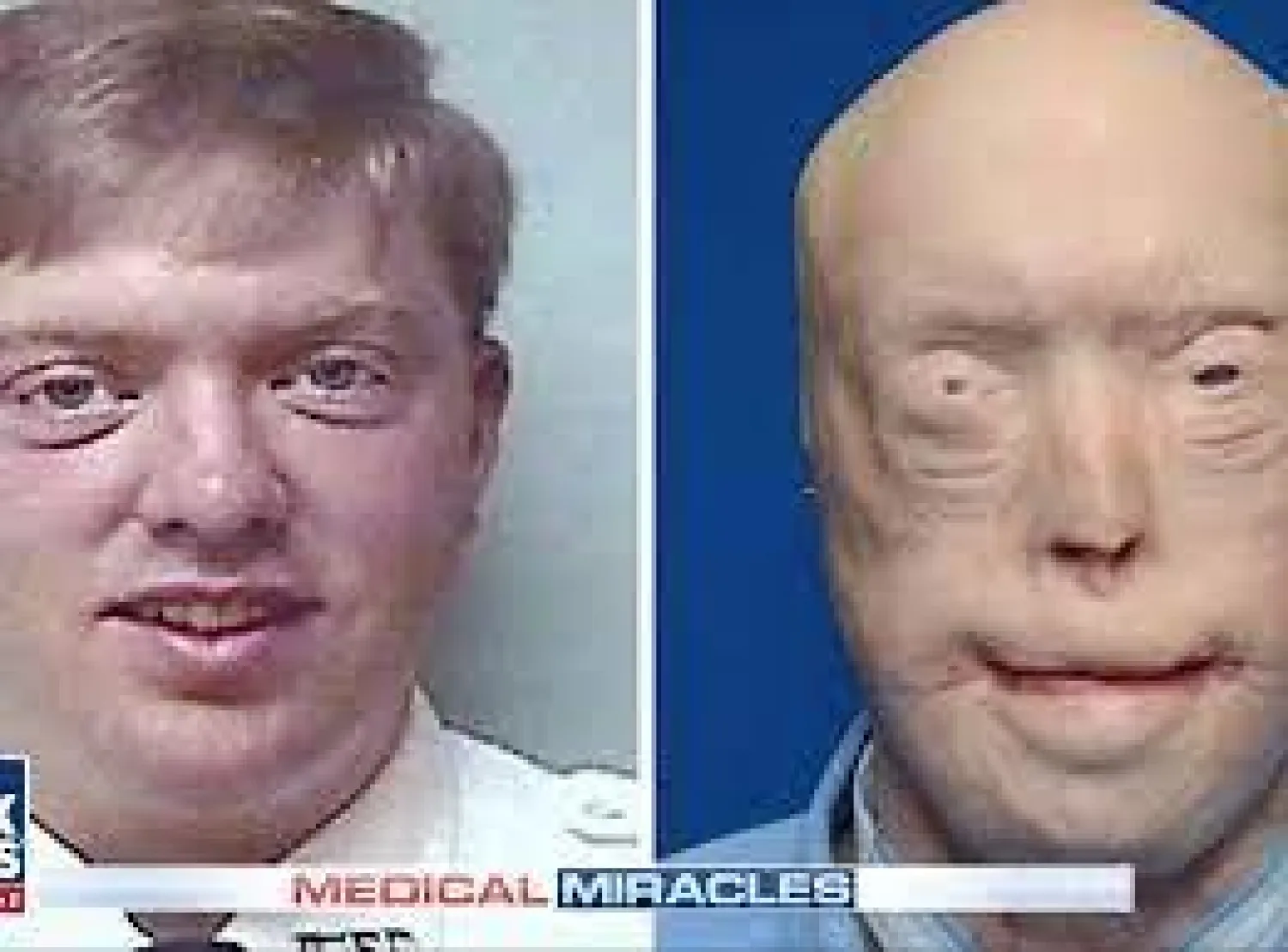 باتريك هارديسون (إندبندنت)