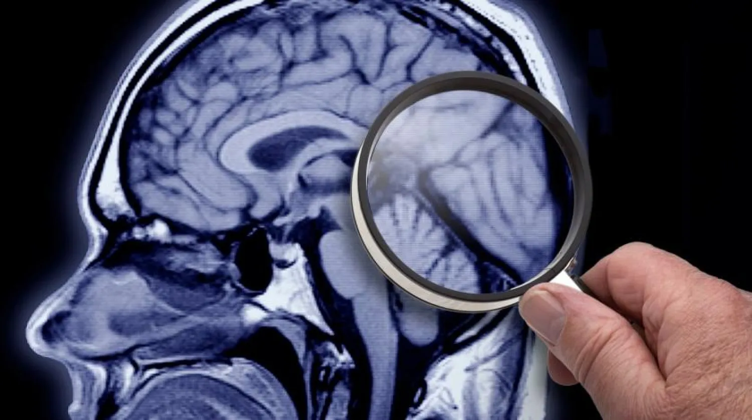 Examining the mind. Getty images