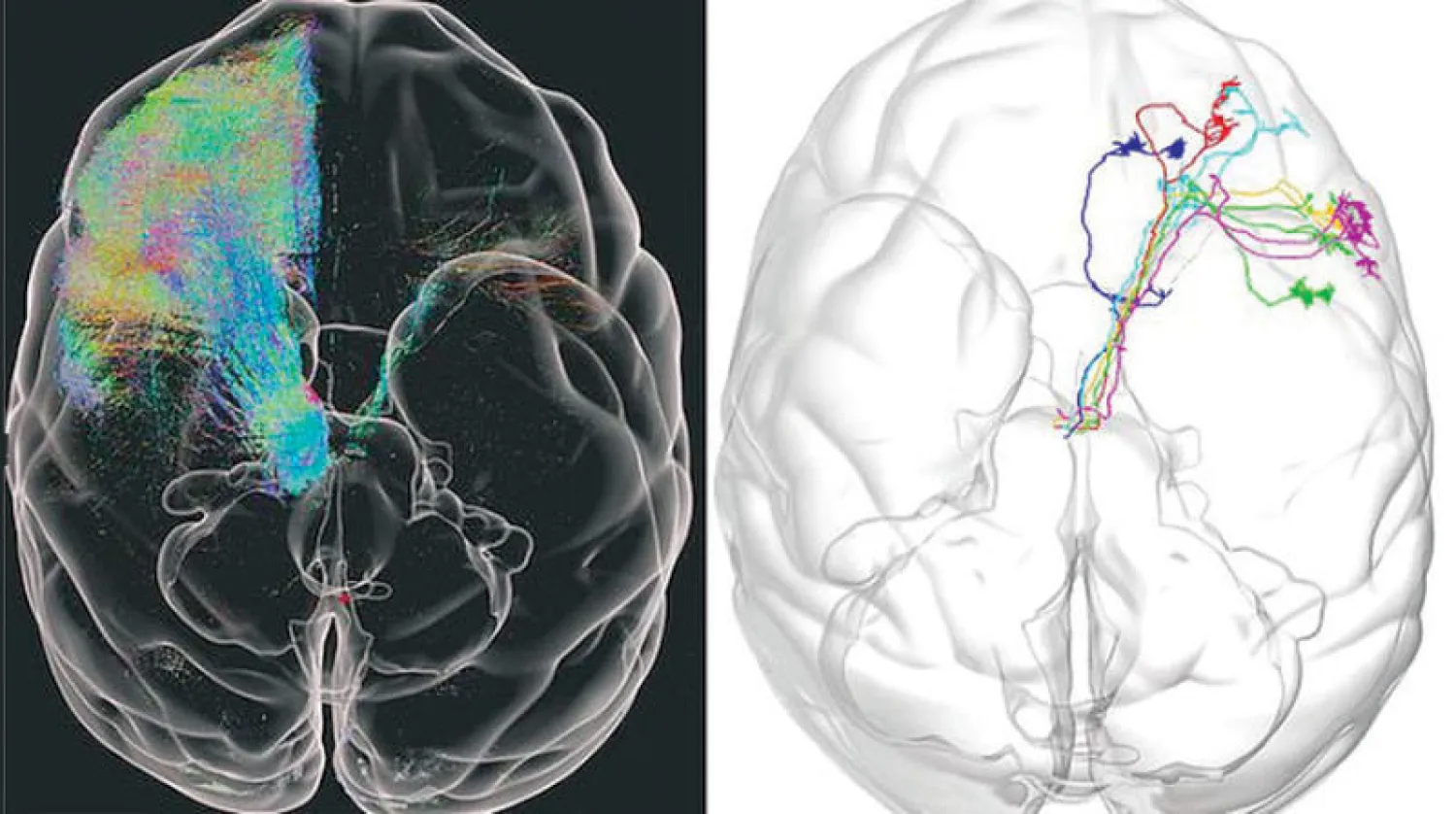 رسم خريطة مفصلة لدماغ قرد (غيتي)