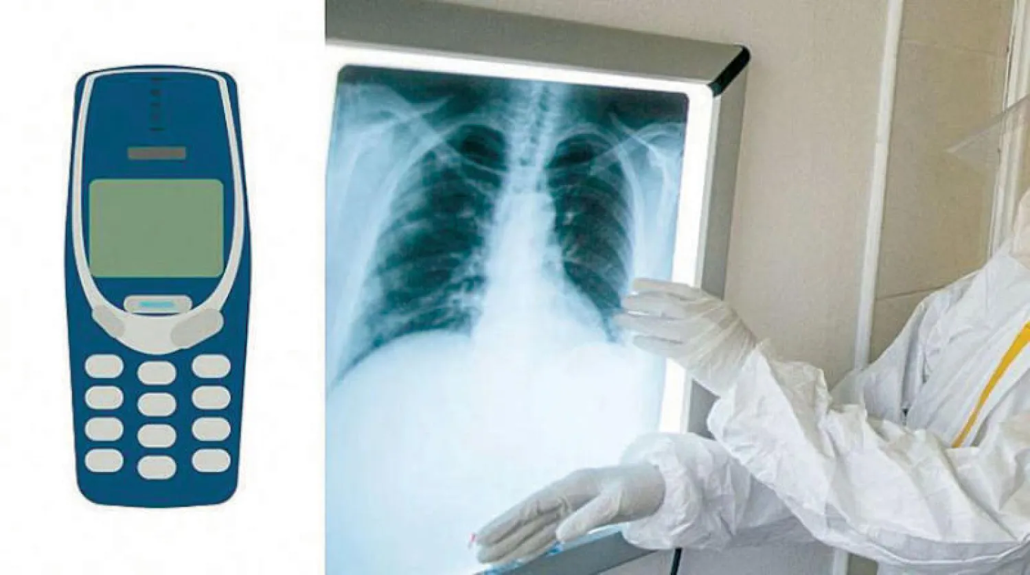 استخراج هاتف نوكيا من دون شقّ البطن (أ.ب)