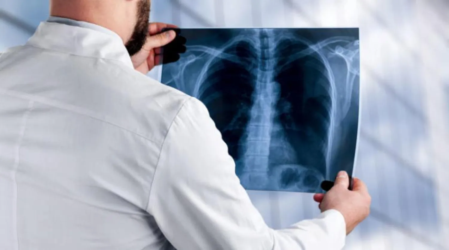 Akciğer kanseri için BT taramaları (Shutterstock)