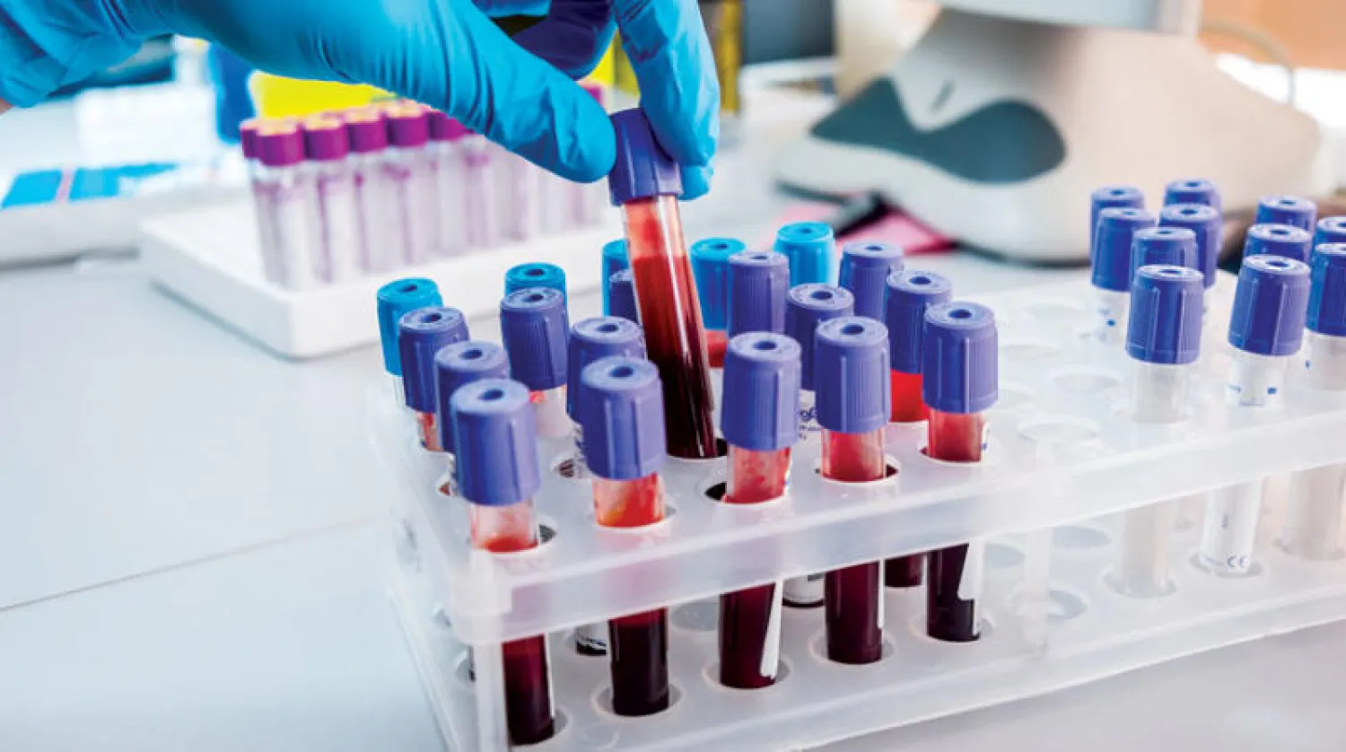 بريطانيا تبدأ أكبر تجربة  لاختبار دم لـ50 نوعاً من السرطان