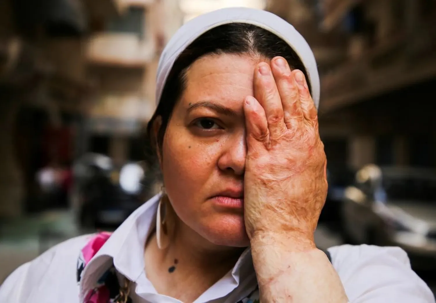 Hend el-Banna, founder of “Containment” initiative to support people with burns, poses during a video with Hanan Ashraf as part of her initiative's activities in Alexandria, Egypt October 5, 2021. (Reuters)