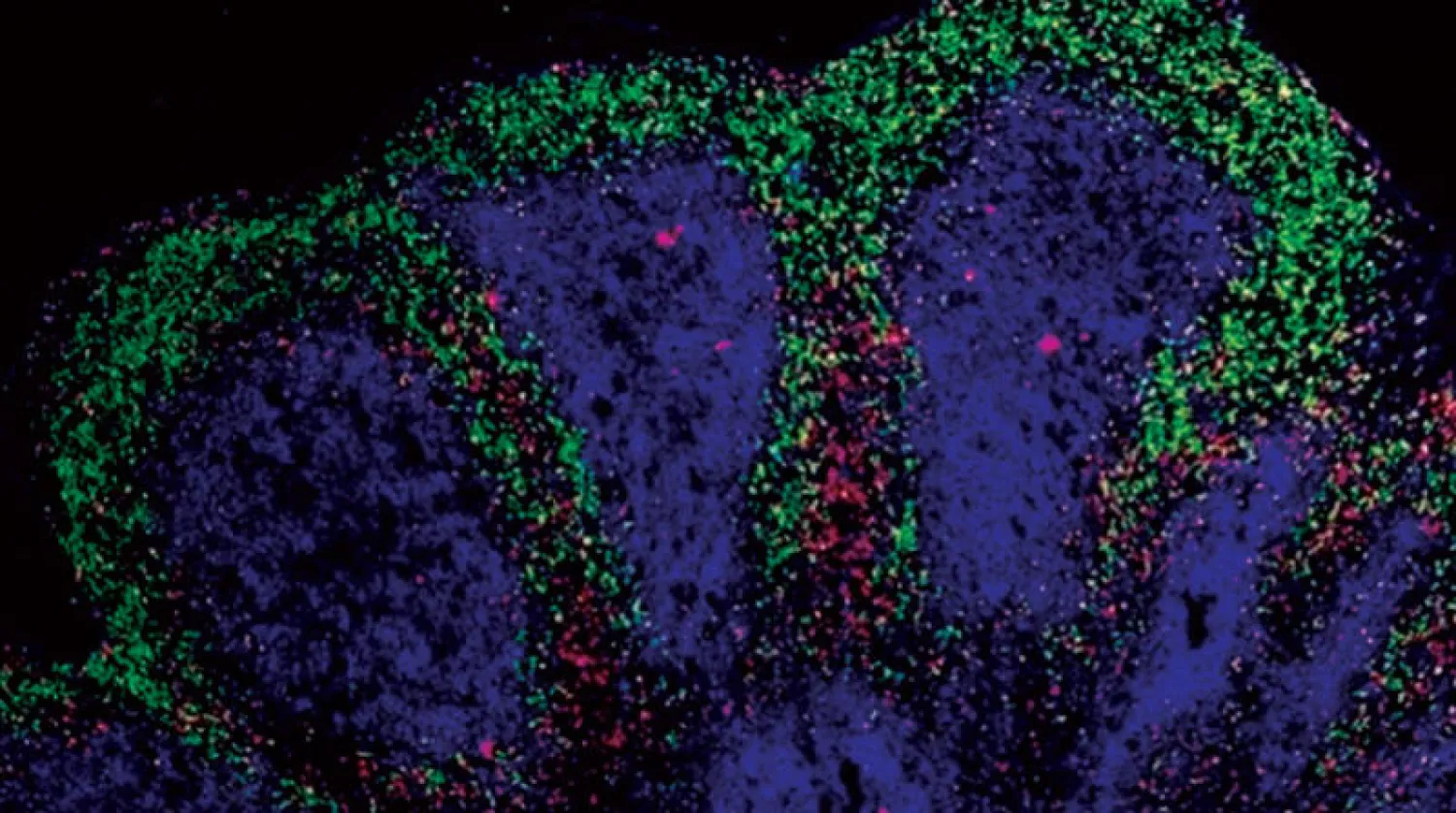 «عضيات الدماغ» أو الدماغ الصغيرة