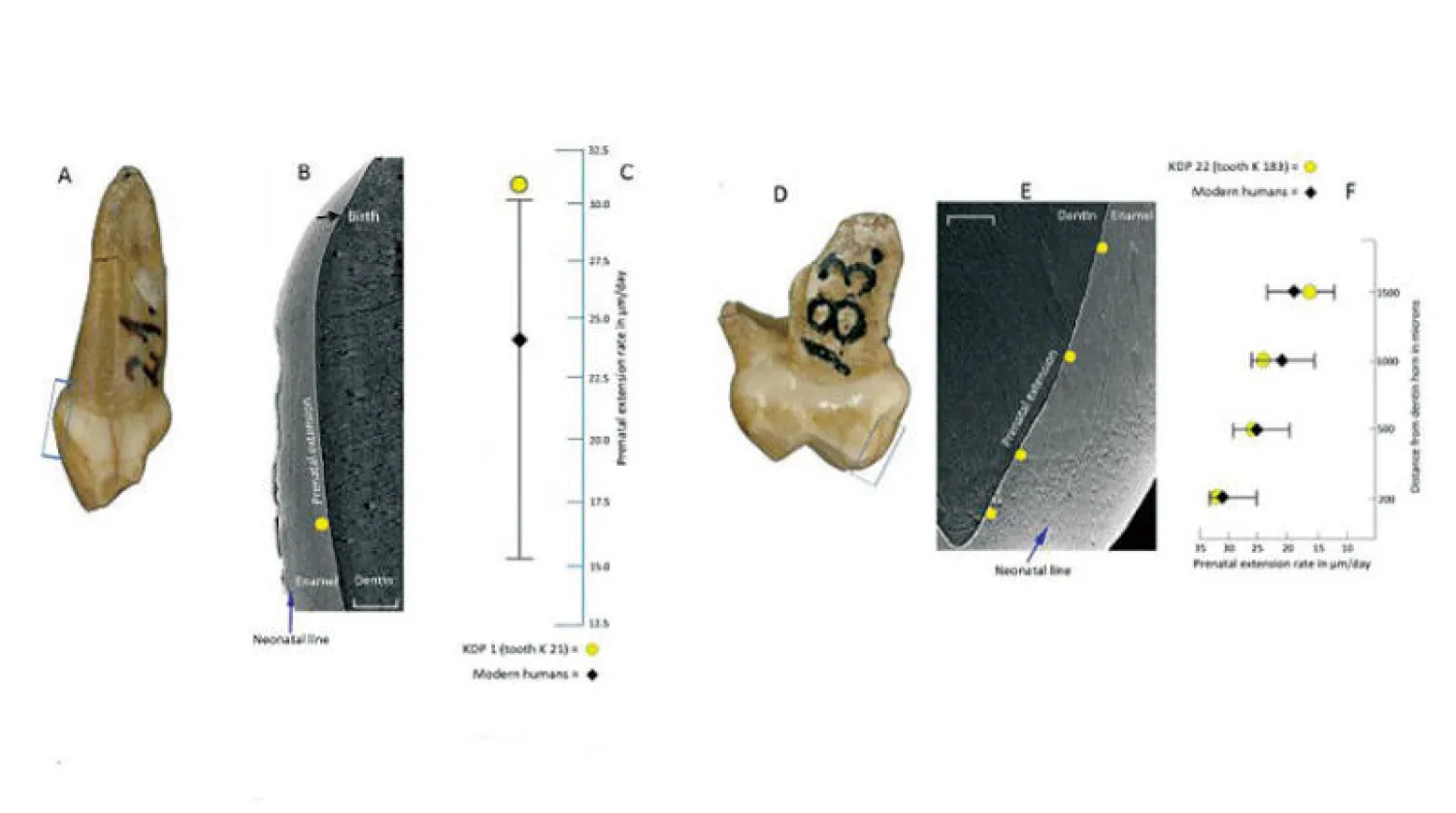 قياسات الباحثين كشفت النمو السريع لأسنان طفل نياندرتال