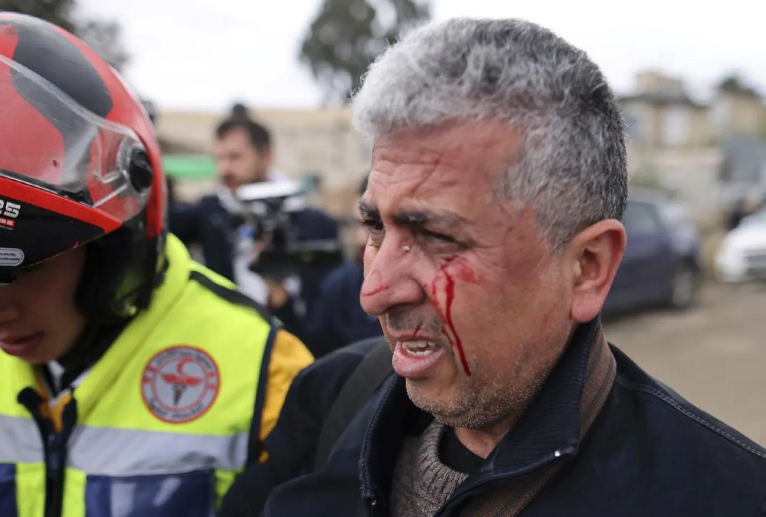 Associated Press photographer Mahmoud Illean reacts after being attacked by Israeli police while covering a demonstration in the east Jerusalem neighborhood of Sheikh Jarrah, Friday, Dec. 17, 2021. (AP)