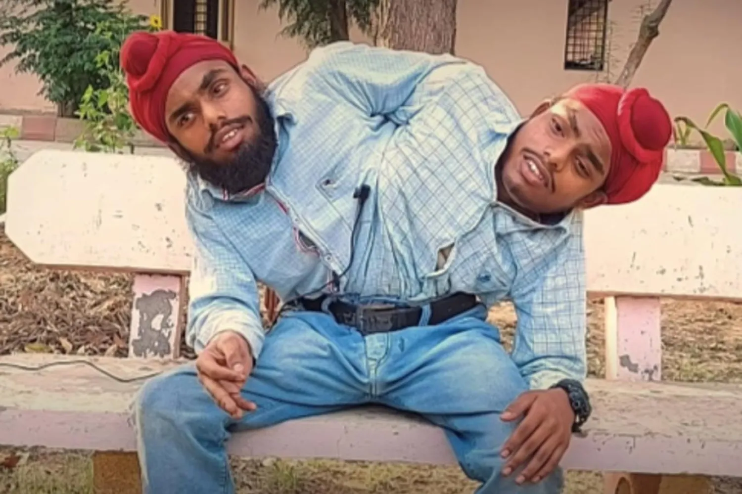 Ebeveynleri tarafından terk edilen 19 yaşındaki yapışık ikizler Sohna ve Mohna, Pencap eyaletindeki Amritsar'da bir iş kaptı (Screengrab/Tangy Tales/YouTube)