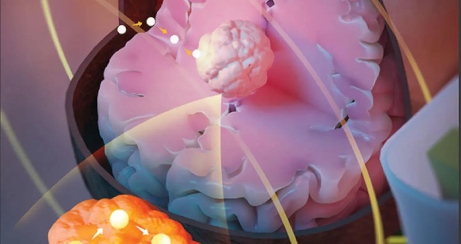 تمرير بذور عبر الدماغ من خلال الرنين المغناطيسي (غيتي)