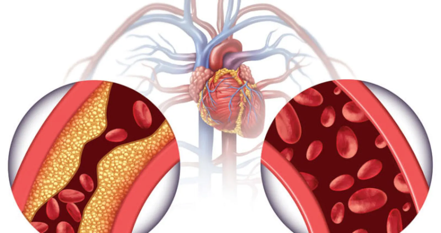 الخفض الفعال لضغط الدم يقلل حدوث مشكلات القلب