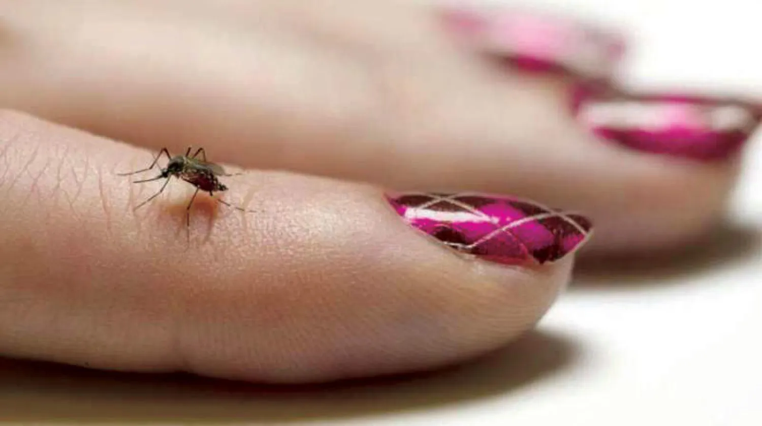 لدغات البعوض