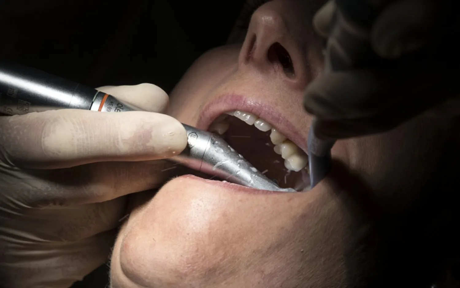 Illustrative: A dentist wearing protective equipment treats a patient in Guebwiller, eastern France, May 20, 2020. (Sebastien Bozon/AFP)