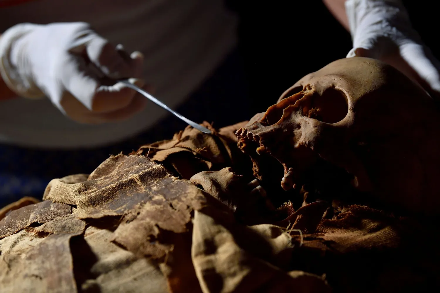 A researcher prepares to move an Egyptian mummy from the Civic
Archaeological Museum of Bergamo to Milan's Policlinico hospital to
undergo a CT scan in order to investigate its history, in Bergamo,
Italy, June 21, 2021. REUTERS/Flavio Lo Scalzo
