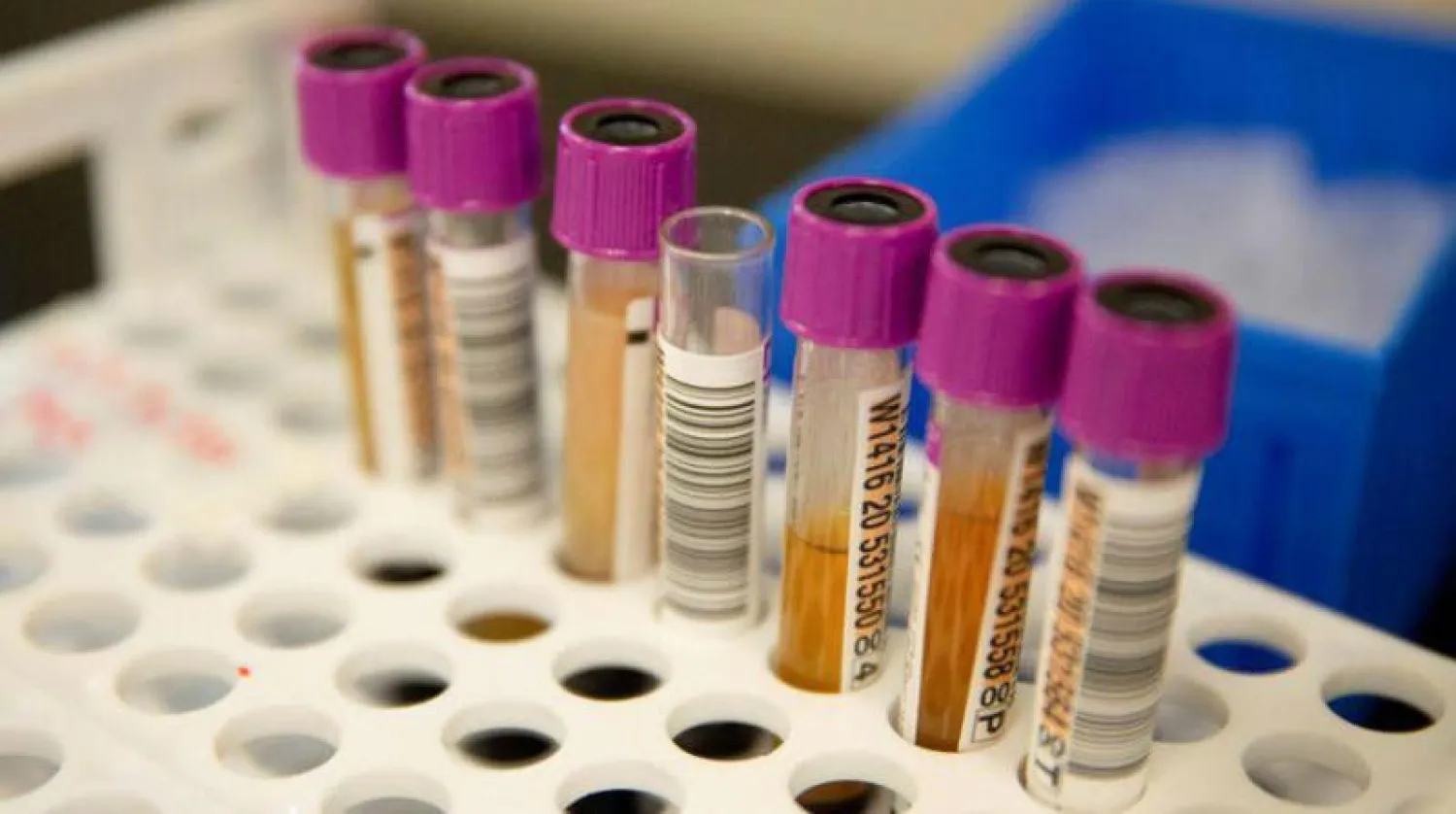 «بلازما النقاهة» فعالة في العلاج المبكر لـ«كوفيد ـ 19»