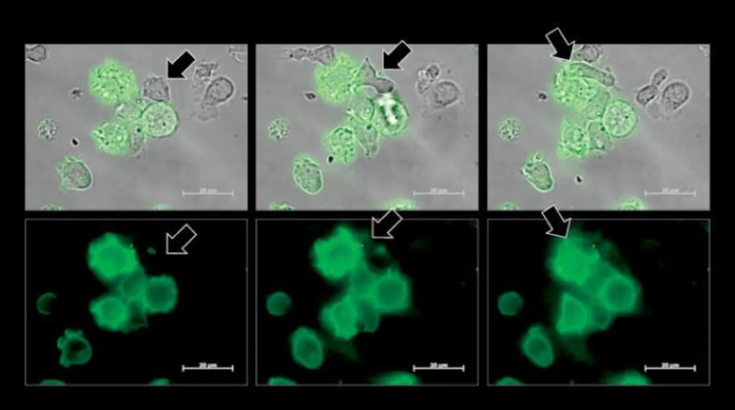 Oklar, kanser hücresinin bir kısmı çalındıktan sonra yeşile dönen doğal öldürücü hücreyi gösteriyor (Araştırma Ekibi)