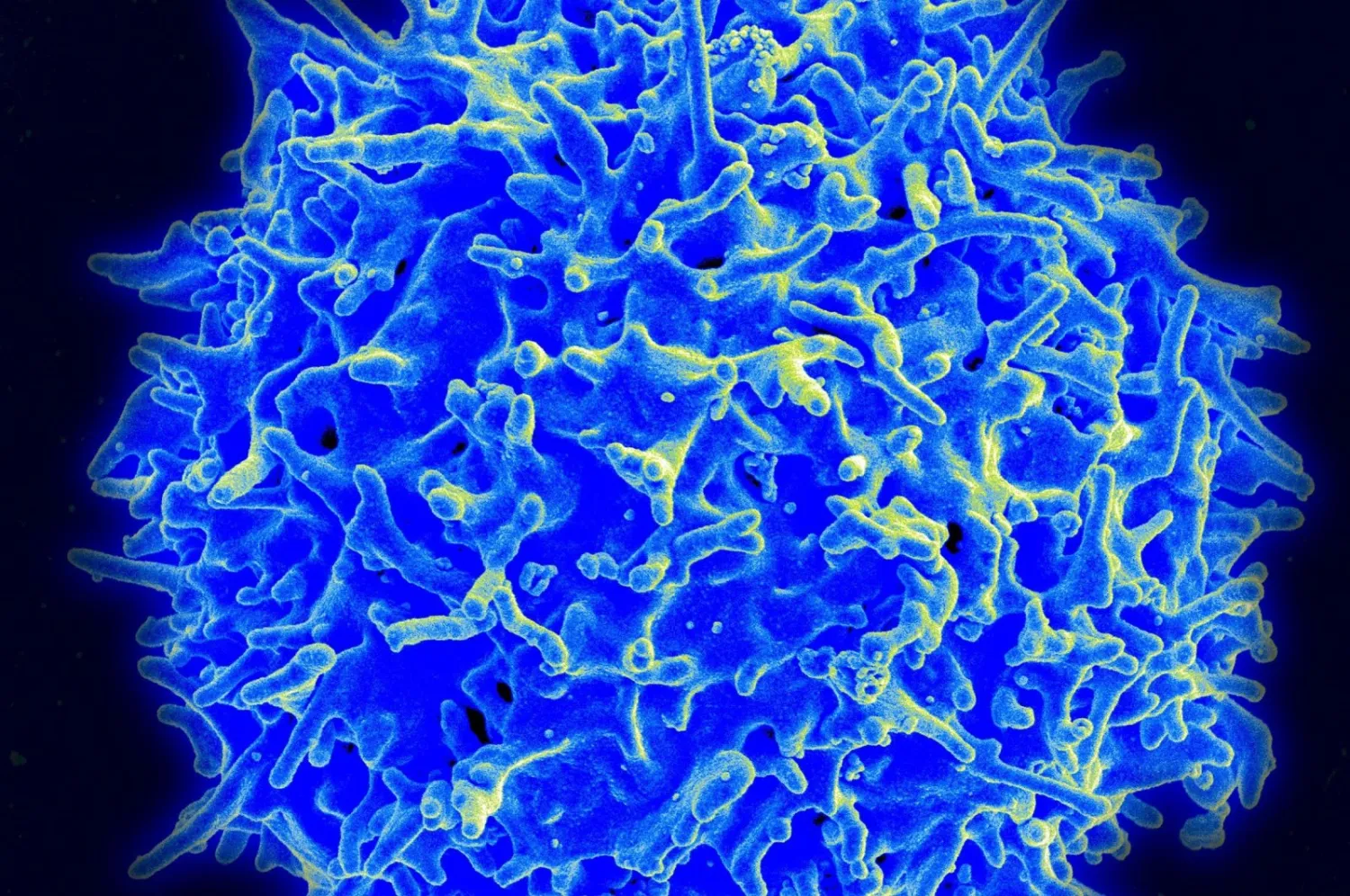 A scanning electron micrograph of a human T lymphocyte (also
called a T cell) from the immune system of a healthy donor, in this
National Institute of Allergy and Infectious Disease (NIAID) handout
photo obtained March 30, 2021. (Photo by Handout / National Institute
of Allergy and Infectious Diseases / AFP)