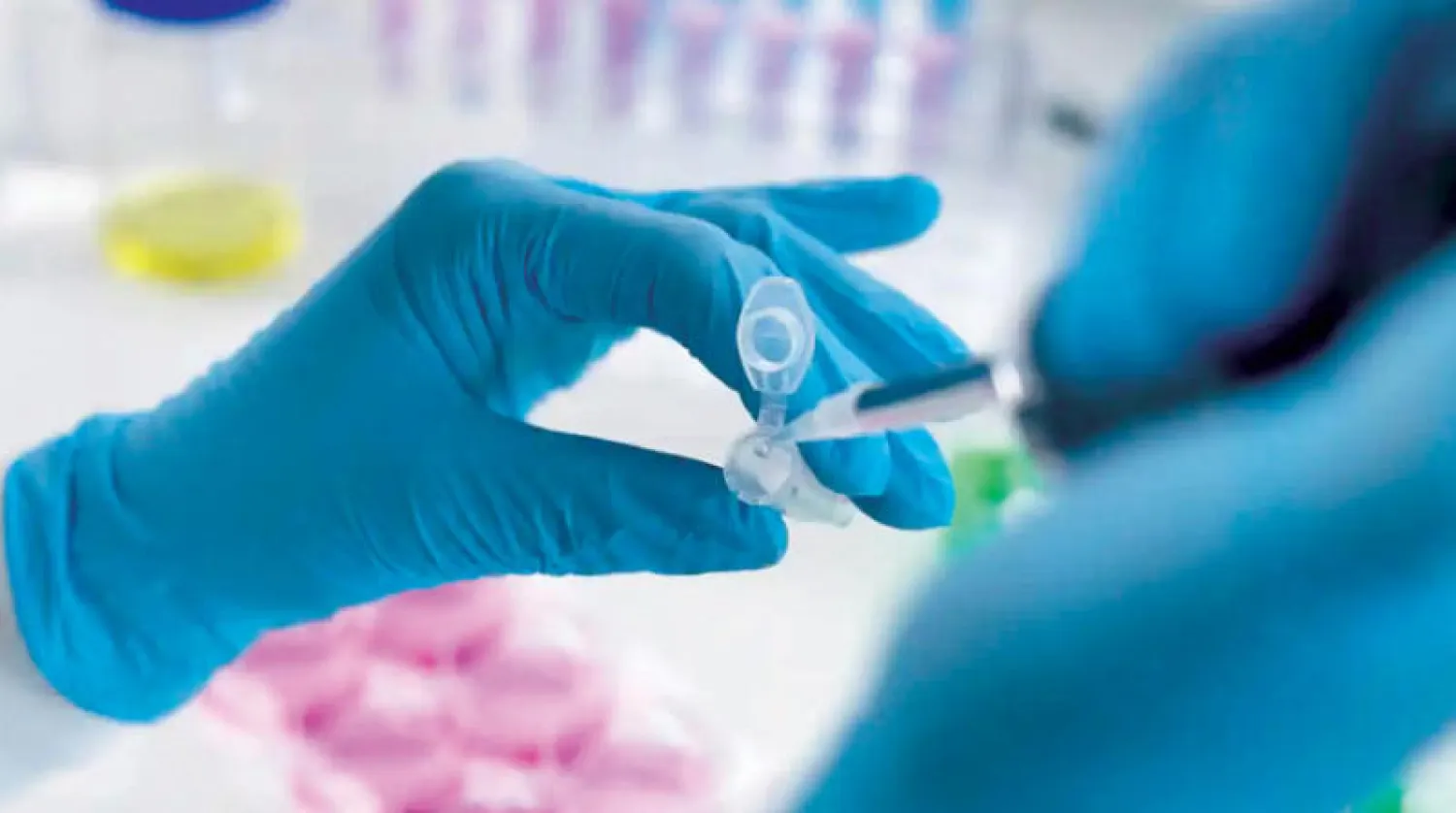 تحليلات جينية معقدة على البول (جامعة إيست أنجليا)