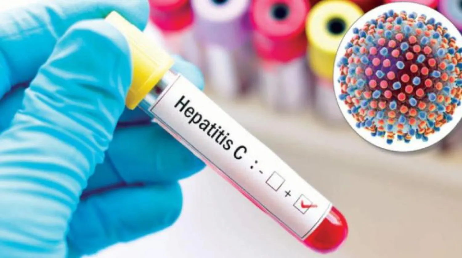 فحص للكشف عن إصابة التهاب الكبد الحاد (أرشيفية - الشرق الأوسط)