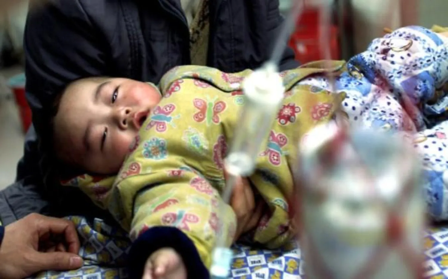 منظمة الصحة العالمية تلقت عشرات البلاغات مؤخراً عن إصابات أطفال بالتهاب الكبد الحاد (رويترز)