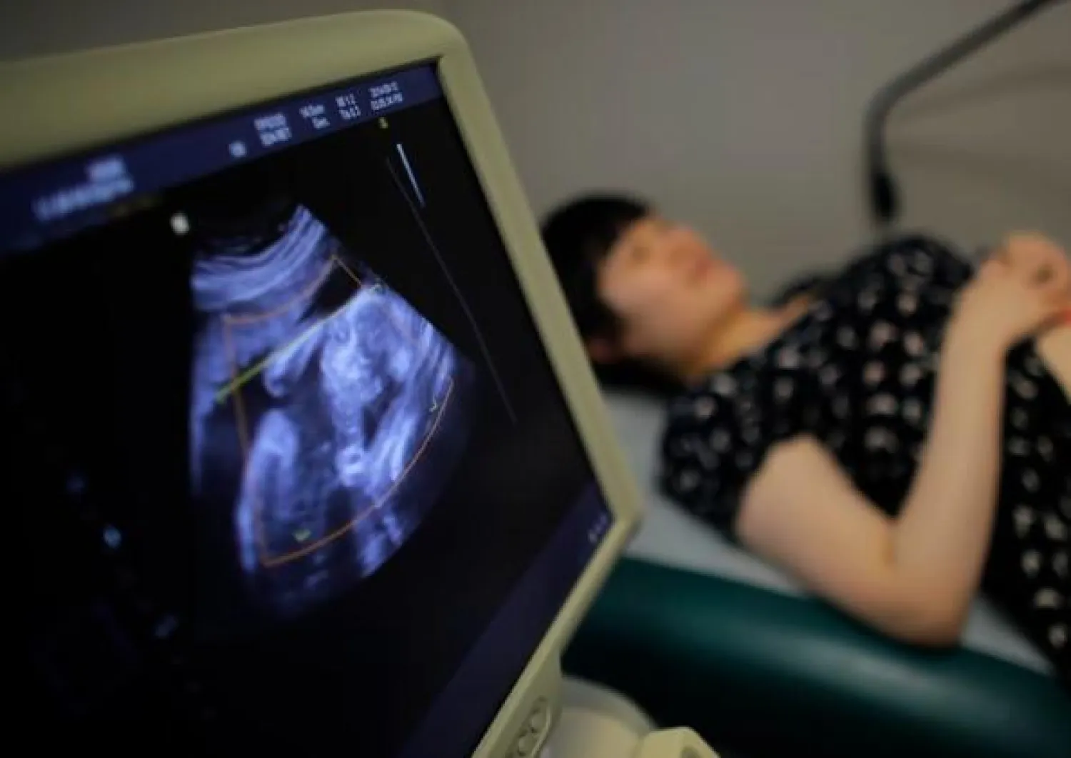 سيدة تخضع لسونار على الرحم (رويترز)