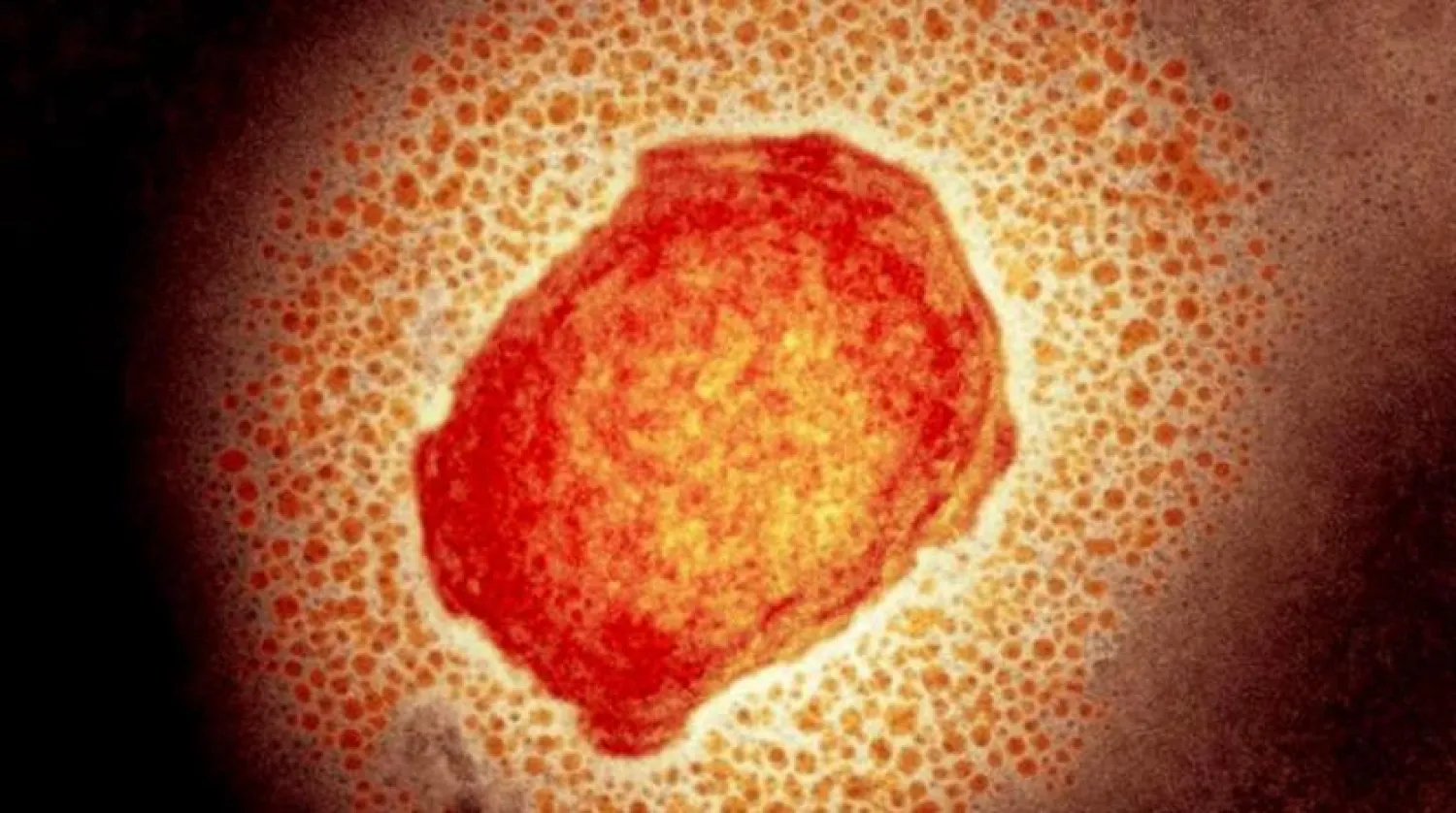 وزارت بهداشت امارات: فرد مبتلا اکنون تحت مراقبت‌های پزشکی قرار دارد (وام)