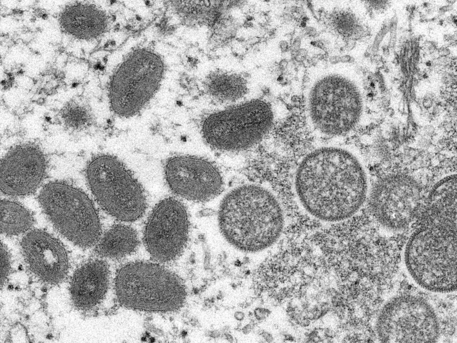 An electron microscopic (EM) image shows mature, oval-shaped monkeypox virus particles as well as crescents and spherical particles of immature virions. Cynthia S. Goldsmith, Russell Regnery, Reuters

