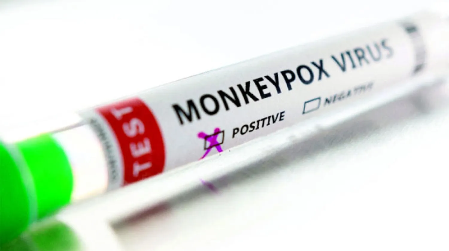 أنبوب يحمل نتيجة فحص عينة ايجابية لـ«جدري القردة» (رويترز)