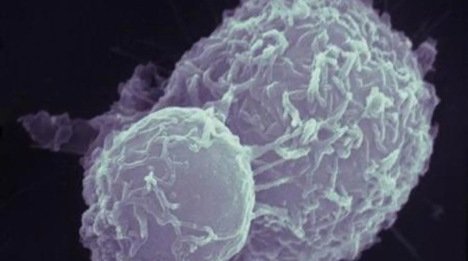 İlaç, kanser hücrelerini tespit ederek, bağışıklık sisteminin onları tanımasını ve yok etmesini sağlıyor (Reuters)