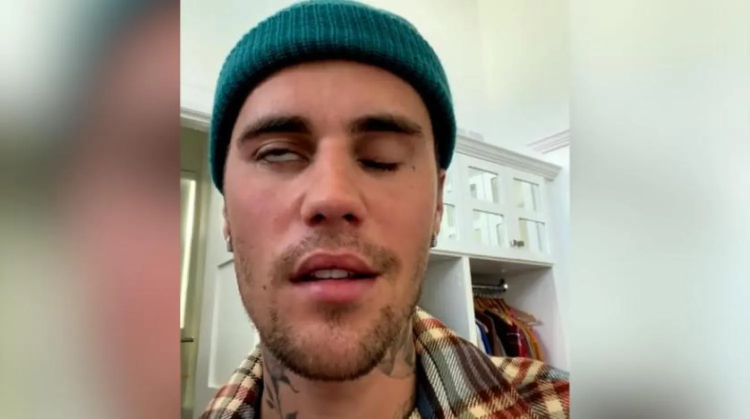 Fotoğraf Altı Yazısı: Ünlü Kanadalı şarkıcı Justin Bieber, hastalığının belirtileri göründüğü esnada (Instagram)