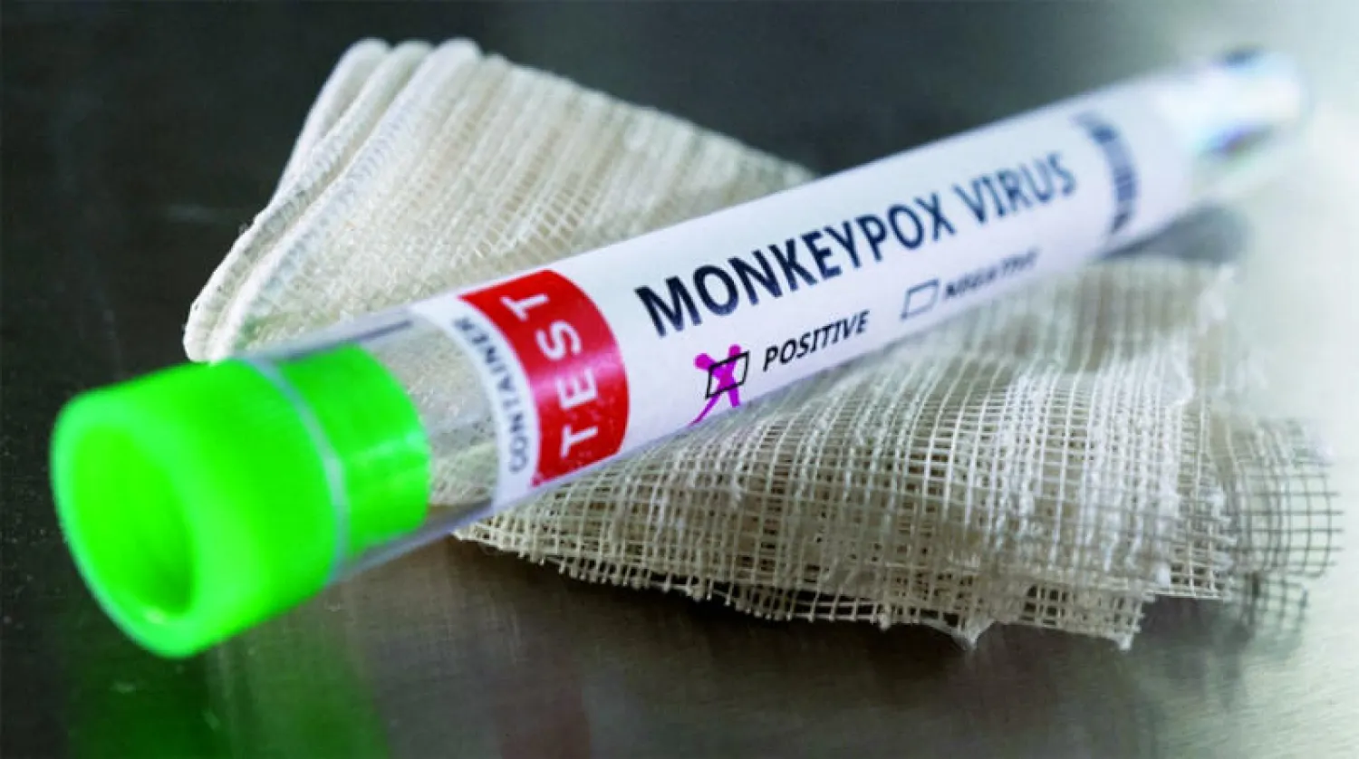 صورة التقطت لإحدى العينات التي ثبتت إصابتها بفيروس جدري القردة (رويترز)