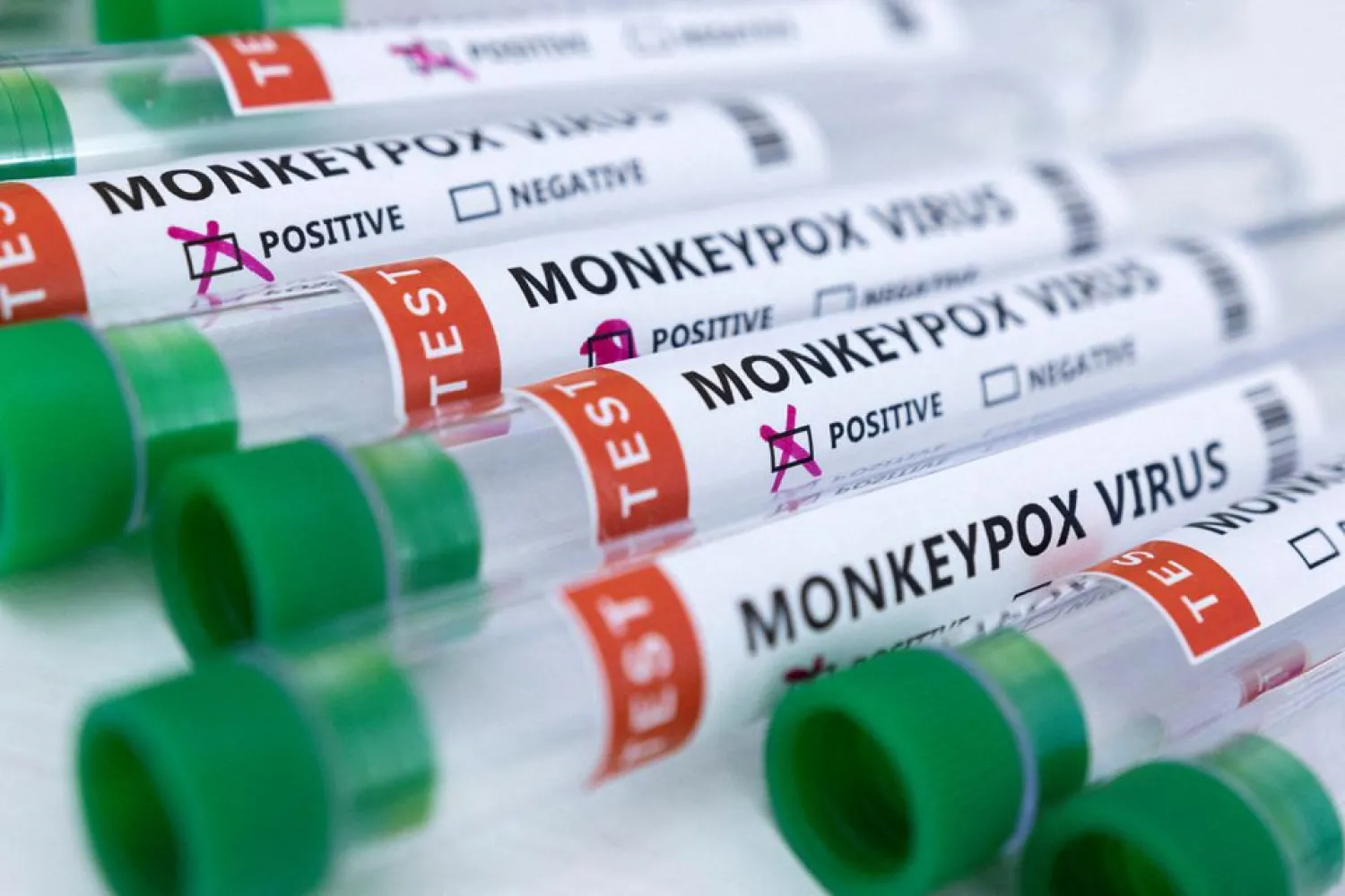 Test tubes labelled "Monkeypox virus positive and negative" are seen in this illustration taken May 23, 2022. REUTERS/Dado Ruvic/Illustration/File Photo

